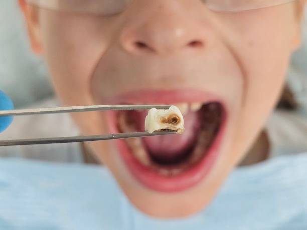 Best Emergency Pediatric Dentist  in Hamtramck, MI